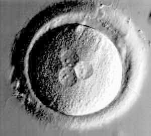 Sviluppo dell'embrione IVF - fecondazione anomala