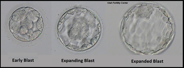 Sviluppo dell'embrione IVF - stadio di blastocisti - giorno 5