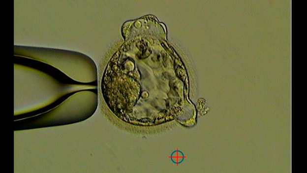Sviluppo dell'embrione FIV - Koala - foto