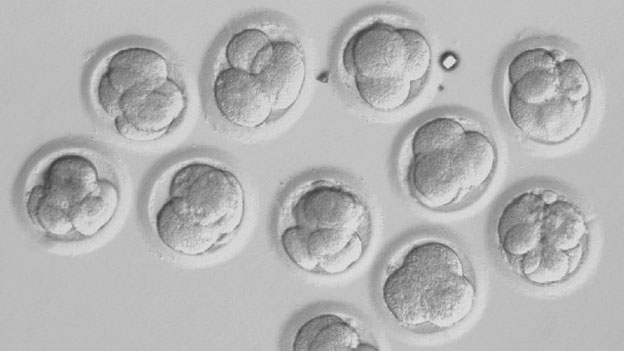 Sviluppo dell'embrione IVF - aspetto al microscopio