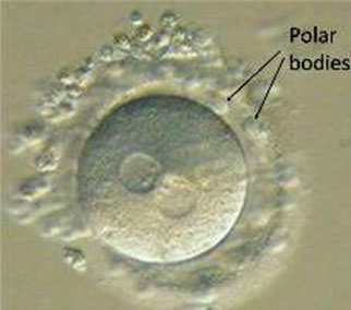 Corpi polari di sviluppo dell'embrione IVF
