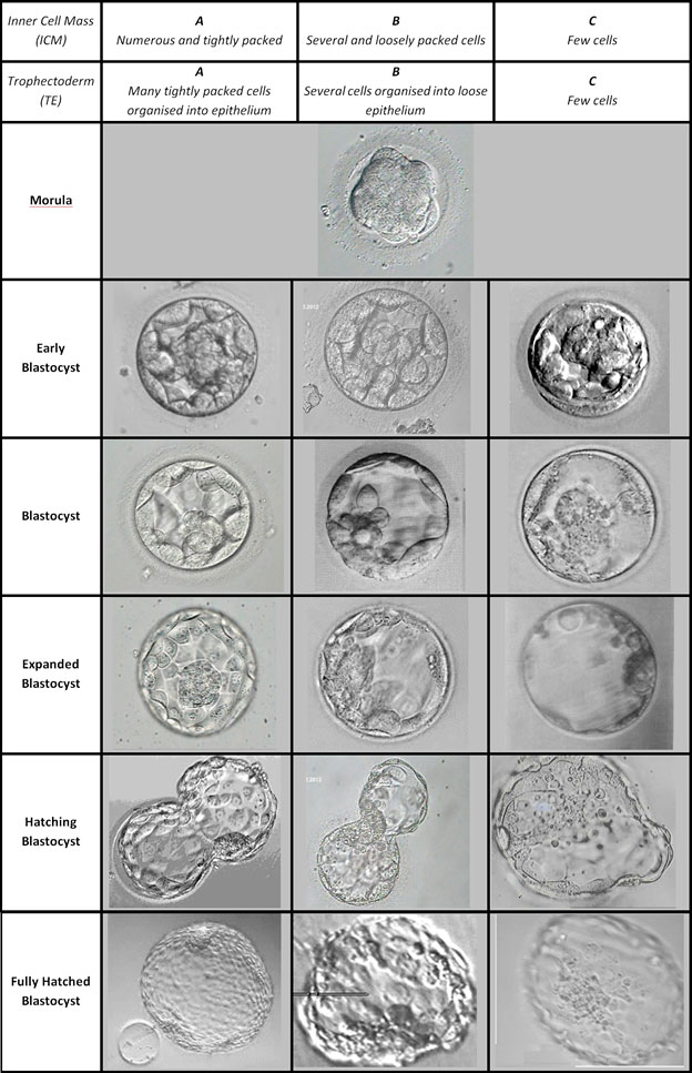Sviluppo embrionale IVF - qualità - classificazione